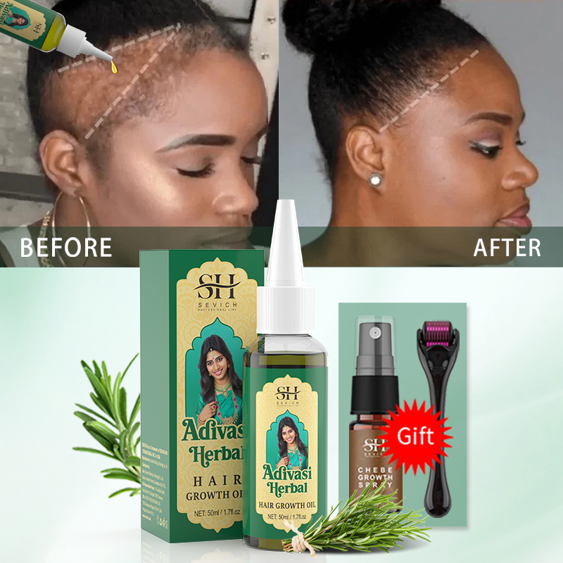 Ajurwedyjski olejek na porost  – Ingrown Hair Serum recenzja i cena