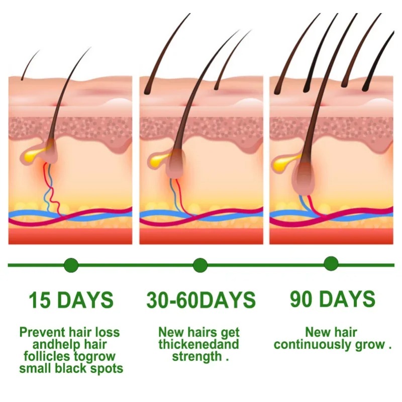 Serum na porost włosów Szybko  – Ingrown Hair Serum recenzja i cena