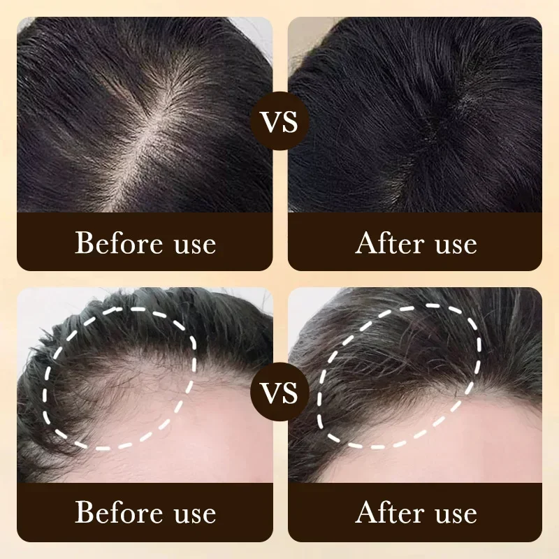 Produkty do pielęgnacji włosów – Ingrown Hair Serum recenzja i cena