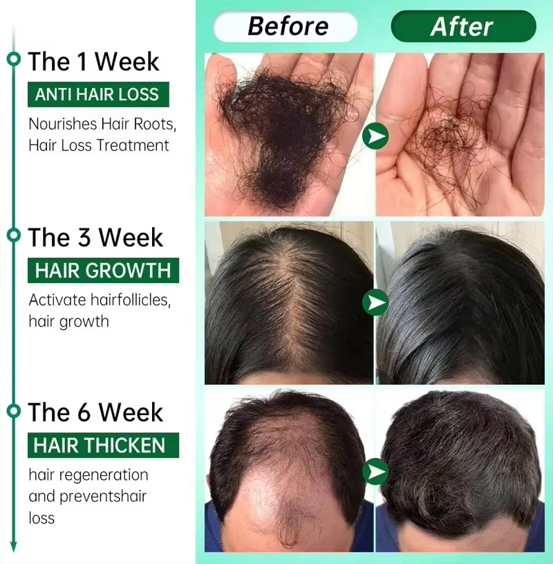 Serum na porost włosów 7-dniow – Ingrown Hair Serum recenzja i cena