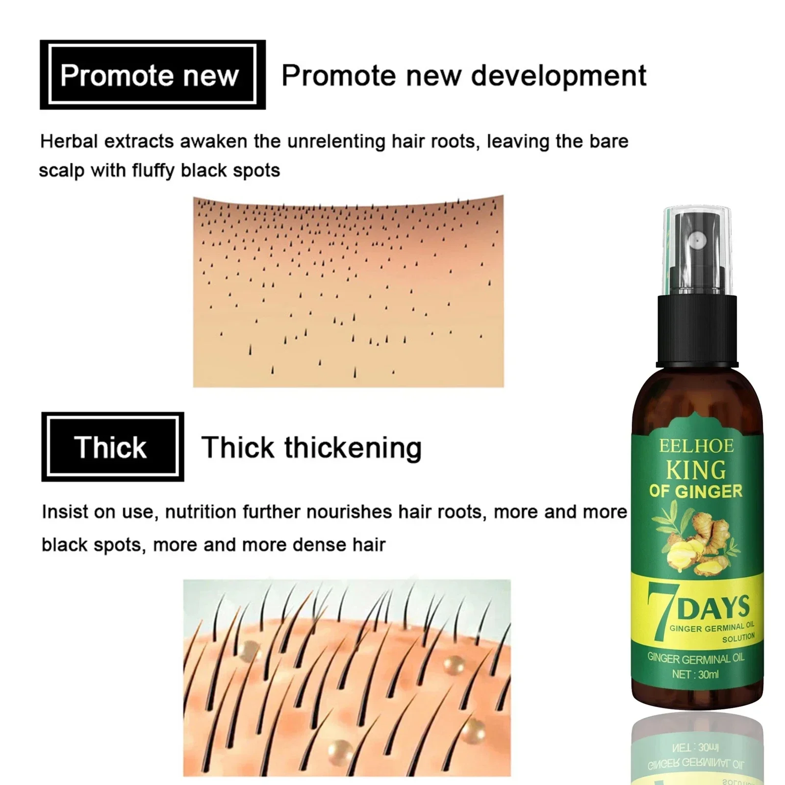 2024 Imbirowe serum na porost  – Ingrown Hair Serum recenzja i cena