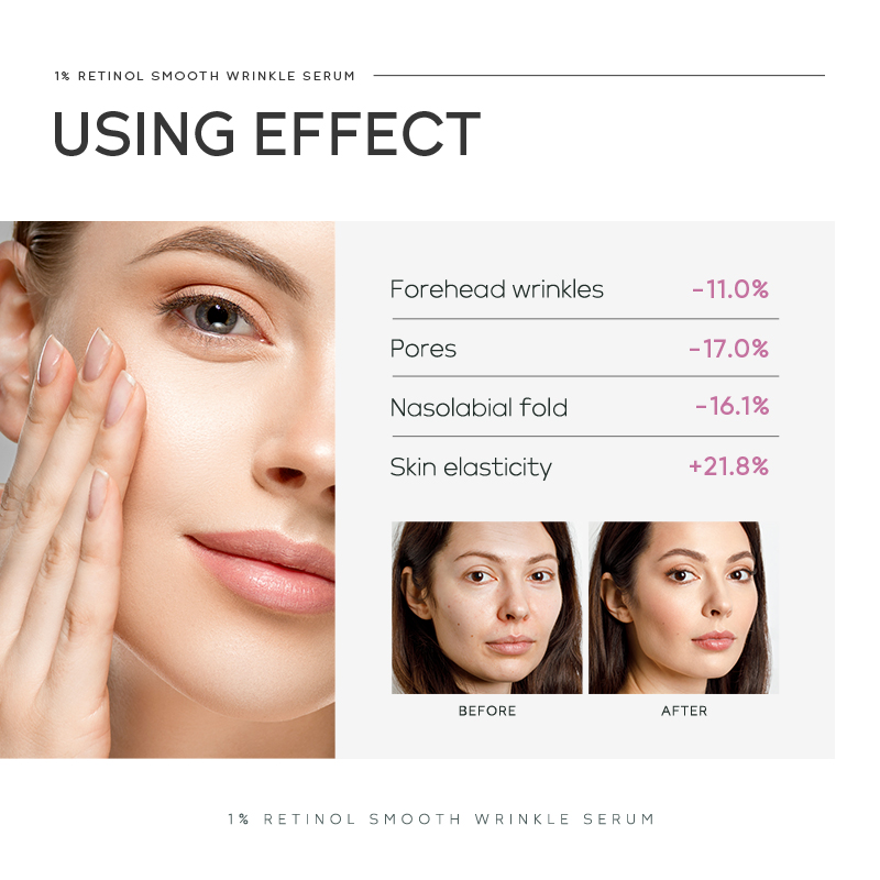 Quiyum 1% Retinol Smooth Wrink – The Ordinary Serum Hyaluronic Acid recenzja i cena