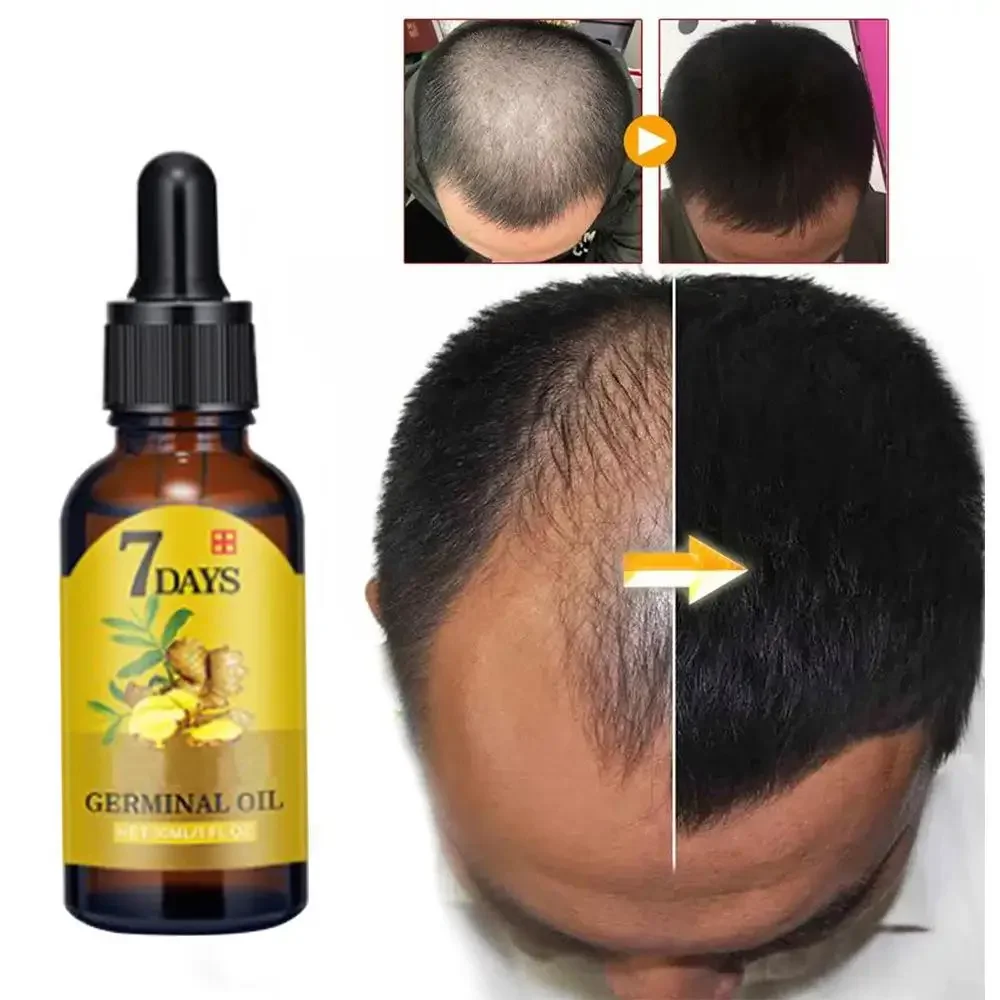 Wzrost włosów Imbir Szybko ros – Ingrown Hair Serum recenzja i cena