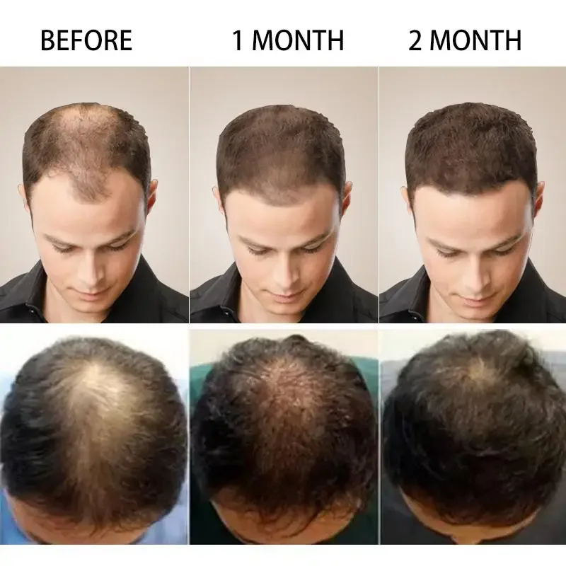 Wzrost włosów Imbir Szybko ros – Ingrown Hair Serum recenzja i cena